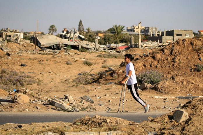 UNRWA: Purata 10 Kanak-Kanak Gaza Kehilangan Kaki Setiap Hari